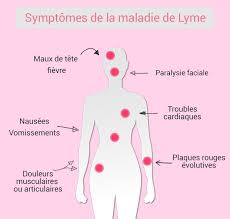 dessin du corps humain fond rose-la-maladie-de-Lyme-y-voir-plus-clair-Part.2-Atlaneastro
