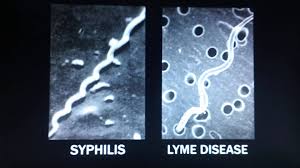 bactérie syphilis er borélia Lyme côte à côte bactéries Part.1-Atlaneastro
