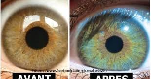 oeil marron et oeil bleu yeux Part.2-Atlaneastro